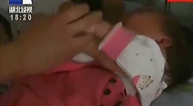 Bé gái 2 tuổi bị chấn thương cột sống nặng vì bị bố tung lên trời để bắt chước video trên mạng