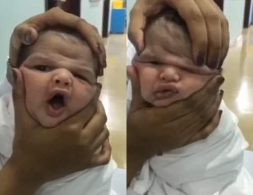 Bóp méo mặt trẻ sơ sinh để quay video câu like tàn nhẫn, nhóm y tá bị sa thải ngay lập tức