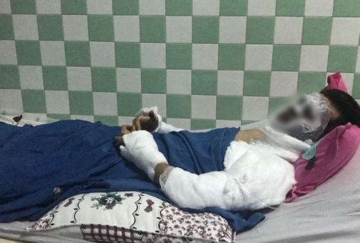 Bạn trai bị cách ly trong phòng hồi sức, cô gái Việt Kiều bị tạt axit thổn thức 