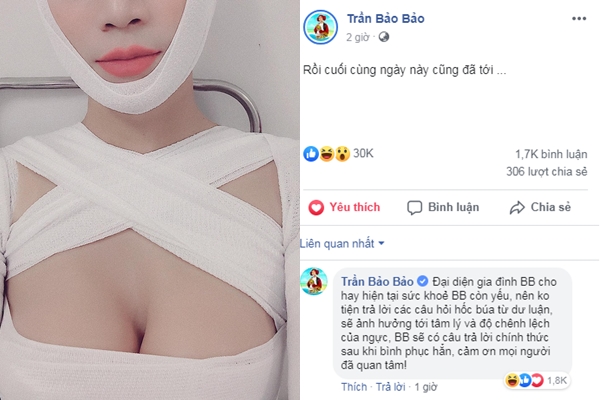 BB Trần khiến fans và bạn bè nghệ sỹ "sững sờ" vì đăng ảnh làm ngực?