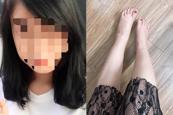 Cô gái cắt tóc, giảm cân theo ý muốn bạn trai, sau đó vẫn bị chia tay phũ phàng vì lý do "chân to như chân trâu"