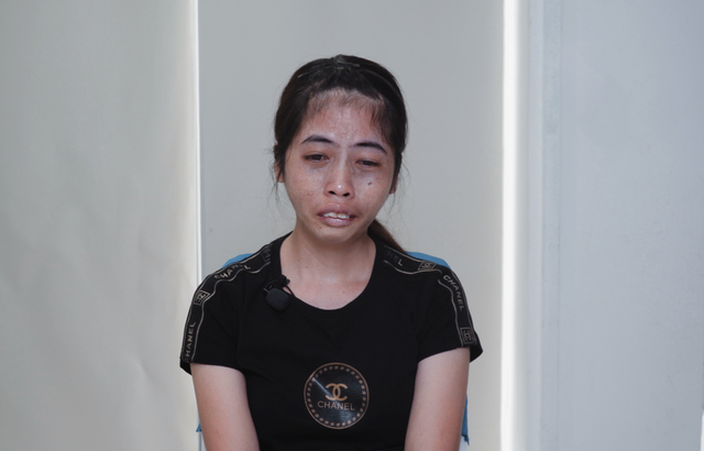 Từ một cô gái xấu xí bị người đời miệt thị, 9x Bình Thuận đã có màn 