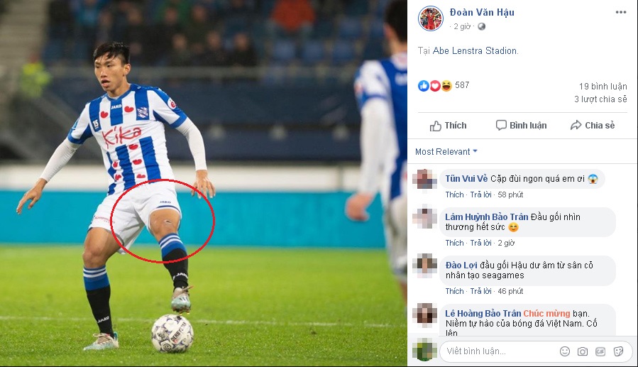 Văn Hậu khoe ảnh ra sân ở SC Heerenveen nhưng fans chỉ soi vết thương ở đầu gối: Hậu ơi, nhìn thương hết sức! 