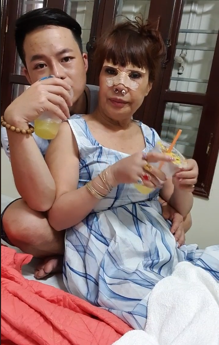 Dù mũi còn sưng sau 1 tuần phẫu thuật, cô dâu 62 tuổi vẫn tự tin chụp ảnh cưới cùng cô dâu 65 tuổi tại Đà Nẵng