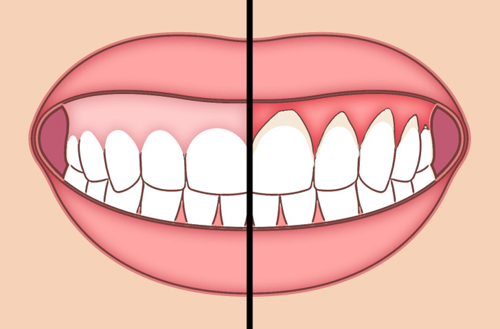 thói quen hàng ngày giúp răng miệng của bạn được bảo vệ
