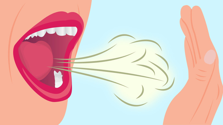 thói quen hàng ngày giúp răng miệng của bạn được bảo vệ