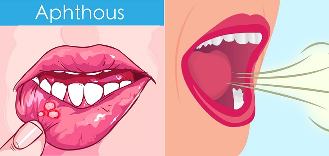 6 thói quen hàng ngày giúp răng miệng của bạn được bảo vệ tốt hơn