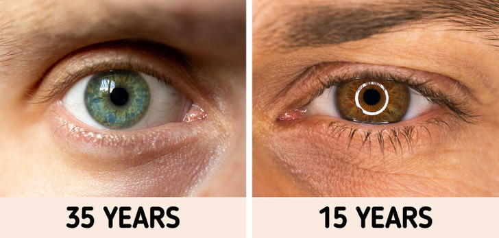 Đôi mắt của bạn có thể tiết lộ bạn sẽ sống bao lâu