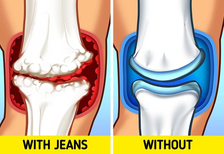 nguy cơ sức khỏe nào nếu bạn mặc quần jean cả ngày