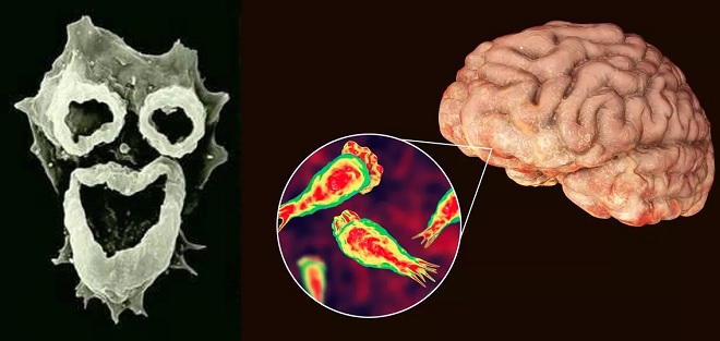 Trùng Amip "xơi tái" não bộ có hình "mặt quỷ" dưới kính hiển vi