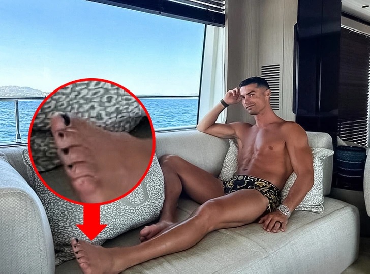 Cristiano Ronaldo sơn móng chân màu đen