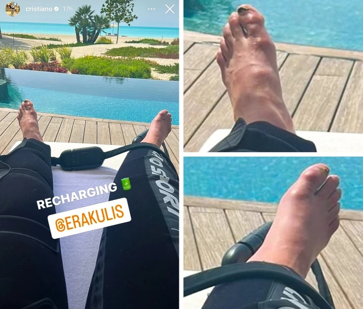 Cristiano Ronaldo sơn móng chân màu đen